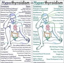 Pin By Dr Karen Zilverberg On Cardiovascular Disease Hypothyroidism Exercise Hyperthyroidism Symptoms Hyperthyroidism