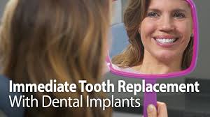 Immediate Tooth Replacement With Dental Implants