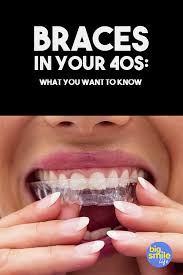 Whether you are hoping to find the affordable solutions than the current cost for braces, an easier regimen for reshaping your teeth or a method that does. How To Get Straight Teeth Naturally Without Braces Arxiusarquitectura