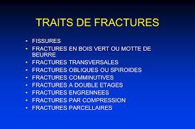 Reconnaissances Cliniques Des Principaux Traumatismes Des Membres Et Du Rachis Dr Bakkouch A Hopital Lariboisiere Paris Ppt Video Online Telecharger