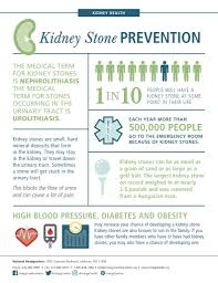Kidney Stones Cause Symptoms And Treatment Urology Centers Of Alabama