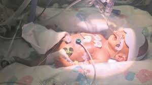 Изучайте релизы eithne ni bhraonain на discogs. After The Neonatal Unit Something Like This It Changes You Forever