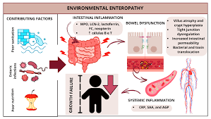 Image result for Intestinal Enteropathy
