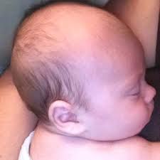 Baby hair loss is perfectly normal, and it often happens within the first six months. Newborn Baby Losing Hair On Top Of Head Newborn Baby