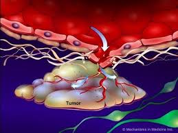 Image result for Angiogenesis
