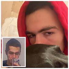 🔥Chico, CA Thursday 6/27/24 @1:03 A.M. BCFAC: Spot fire in the median  closest to Esplanade & Memorial Way. Chico Fire