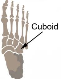 Cuboid Stress Fracture Physioadvisor