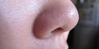Kunyit adalah bahan yang sangat tradisional yang digunakan untuk rawatan kulit. 5 Cara Menghilangkan Bintik Hitam Di Muka Hidung Hidung Hitam Komedo