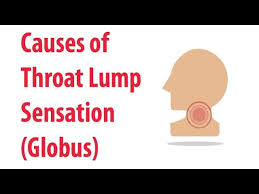 What does a cancerous breast lump feel like? Causes Of Throat Lump Sensation Globus Youtube