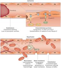 Also set sale alerts and shop exclusive offers only on shopstyle. Intramyocardial Haemorrhage After Acute Myocardial Infarction Nature Reviews Cardiology