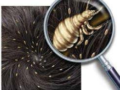 Read reviews from world's largest community for readers. Head Lice Ministry Of Health Nz