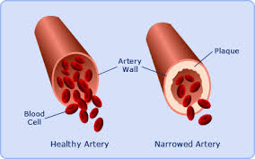 The circulatory system consists of: Cardiovascular Disease Ks3 Cardiovascular Disease