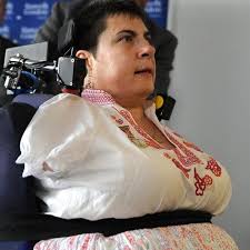 Calls for Thalidomide maker to take responsibility for compensation