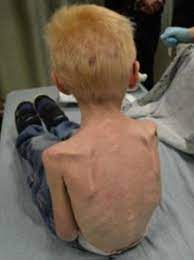 Baby & children's clothing store. Emaciated Boy 5 Foaming At The Mouth And Just Hours From Death When Siblings Rescued Him From Harry Potter Cupboard After Stepmum Locked Him In