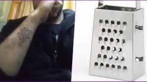 We can provide an indicative total cost of treatment, taking into account flight, insurance and accommodation prices. Worst Tattoo Removal Idea Ever Man Uses Cheese Grater To Scrape Off His Tattoo As He Could Not Get A Job View Pic Latestly