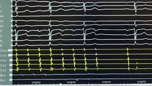 Neil Grubb (@NeilGrubb)