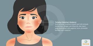 Adanya kandungan antioksidan dan lemak sehat mampu membantu menghidrasi kulit yang terbakar sinar matahari dan mengurangi rasa sakitnya. Terbakar Matahari Sunburn Tanda Dan Gejala Penyebab Cara Mengobati Cara Mencegah