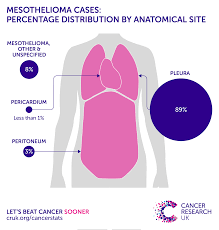 * in general, the overall attributable risk for mesothelioma in women is 23%. Mesothelioma Incidence Statistics Cancer Research Uk