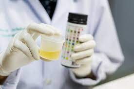 Urine under 5.0 is acidic, and urine higher than 8.0 is alkaline, or basic. Foods That Affect Ph Levels In Urine