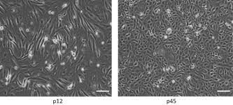 The lineage was developed on 27 march 1962, by yasumura and kawakita at the chiba university in chiba, japan. Assessment Of Potential Mirna Biomarkers Of Vero Cell Tumorigenicity In A New Line Agmk1 9t7 Of African Green Monkey Kidney Cells Sciencedirect
