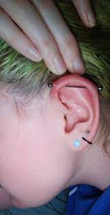 How To Avoid Keloids On Industrial Piercing