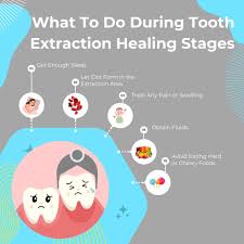 Image result for Tooth Extraction