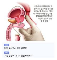 전립선암 진단하는 방법