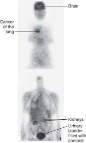 By ra as abbreviation means respiratory. Hrt Definition Of Hrt By Medical Dictionary