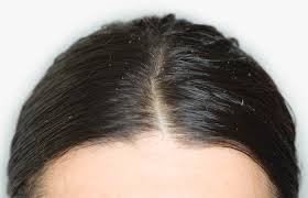 Recent studies have suggested that women are not eating enough protein and since your body needs protein to make hair strong, a lack of it may be contributing to fine, thin or thinning hair. 11 Side Effects Of Hair Smoothing