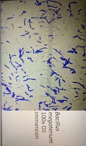 Sarcina lutea is on facebook. Solved Sarcina Aurantiaca 100x Oil Immersion Results A S Chegg Com