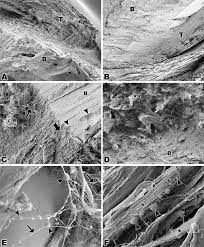 Appendix images under the microscope captured with an hd microscopy camera and info on the appendix. Scanning Electron Microscopy Of Bone Tendon Junction Of The Calcaneal Download Scientific Diagram