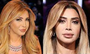 نوال الزغبي تتألق بإطلالة ذهبية في حفل رأس السنة.لكن هذا خطأها ! Ù…Ø´Ø§Ù‡ÙŠØ± Ø§Ù„Ø¹Ø±Ø¨ Ù‚Ø¨Ù„ ÙˆØ¨Ø¹Ø¯ Ø¹Ù…Ù„ÙŠØ© ØªØ¬Ù…ÙŠÙ„ Ø§Ù„Ø£Ù†Ù