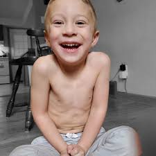 Hey, heart warriors: show us your zipper! #ZipperClub #HeartMonth  Congenital heart disease (CHD), a type of defect in one or more structures  of the heart or blood vessels, occurs in 8 out