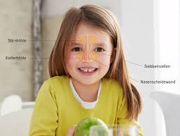 Antibiotikum hilft nicht gegen entzündete nebenhöhlen. Nasennebenhohlenentzundung Symptome Hausmittel Pascoe