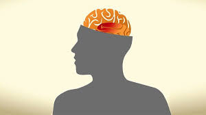 How long do headaches last after a concussion. Post Concussion Syndrome What You Need To Know Everyday Health
