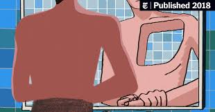 Opinion My Not So Bad Birth Defect The New York Times