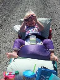 post op update closed hip reduction spica cast bilateral hip dysplasia 18 months old little tikes wagon for hip dysplasia baby hip babies hip reduction