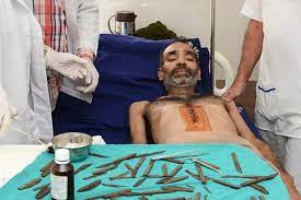 Policial sente um 'leve' desconforto depois de engolir 40 facas - Mega  Curioso