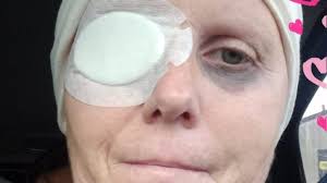 Rintraccia la madre biologica per una cura sperimentale contro il cancro:  la storia di Daniela Molinari