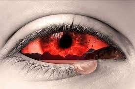 Image result for Dry Eye