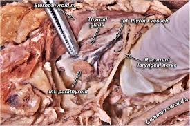 Maybe you would like to learn more about one of these? The Prevalence And Anatomy Of Parathyroid Glands A Meta Analysis With Implications For Parathyroid Surgery Springerlink