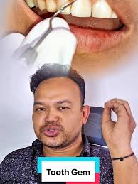 Tooth Gem: सुरक्षा र प्रयोगका लागि ज्ञान उपलब्ध गरौं