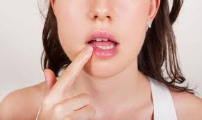 Virusul herpes simplex se găsește sub două forme: AdevÄrul Despre Herpesul Bucal Mamaplus