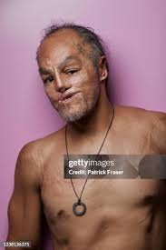 David Lopez Jackson. David was adopted by plastic surgeon Professor... News  Photo