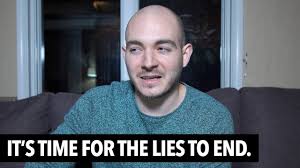Hair loss, also known as alopecia or baldness, refers to a loss of hair from part of the head or body. Why I Stopped Taking Kratom Is It Truly Safe Educational Youtube