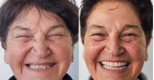 Transforming lives one smile at a time