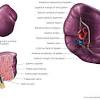 It could also be related to the inflammation of your organs. 1