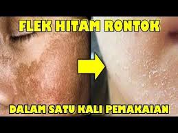 Flek Hitam Rontok Dalam Satu Kali Pemakaian Cobain Resep Ini 100 Ampuh Youtube In 2020 Health And Beauty Tips Face And Body Beauty Hacks