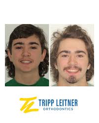 Tripp Leitner Orthodontics