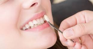 Common Dental Issues Cosmetic Dentistry Treatments Can Fix